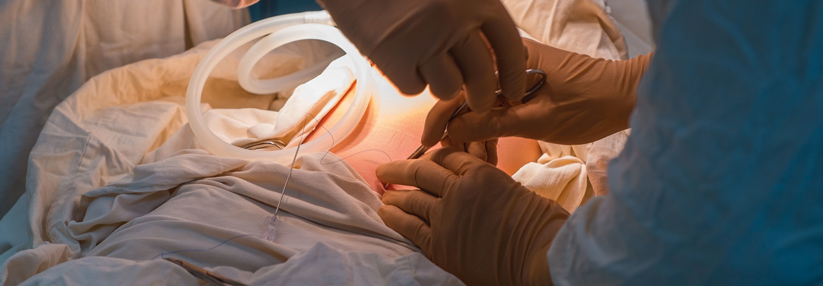 Die beste Option für Ihre Gesundheit: Magenverkleinerung Türkei