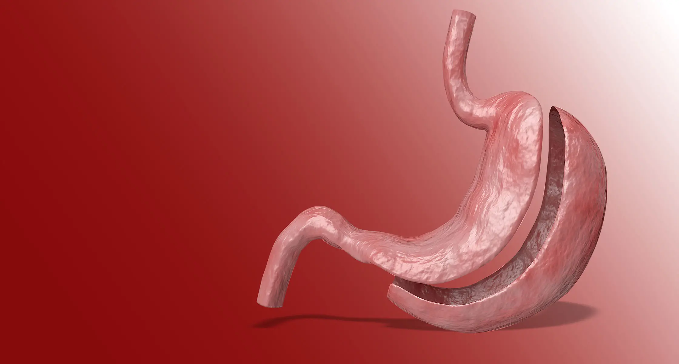 Die beste Option für Ihre Gesundheit: Magenverkleinerung Türkei